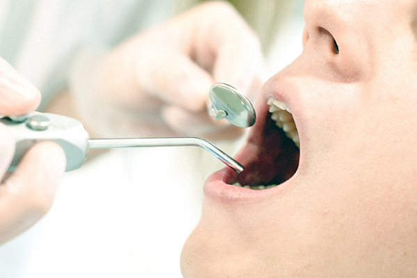 一般歯科の診療について